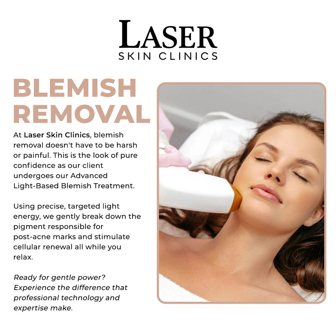 Blemish Removal (Spider Veins, Moles, Skin Tags, Skin Blemishes)