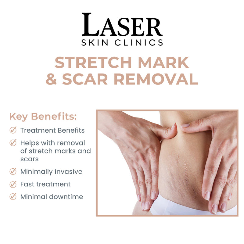 Stretch Mark & Scar Removal