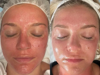 Exosomes the complete Exo|e skin revitalising complex system. Detox, Treat and Repair