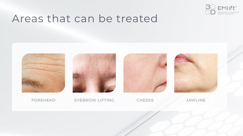Emlift Facial Lifting