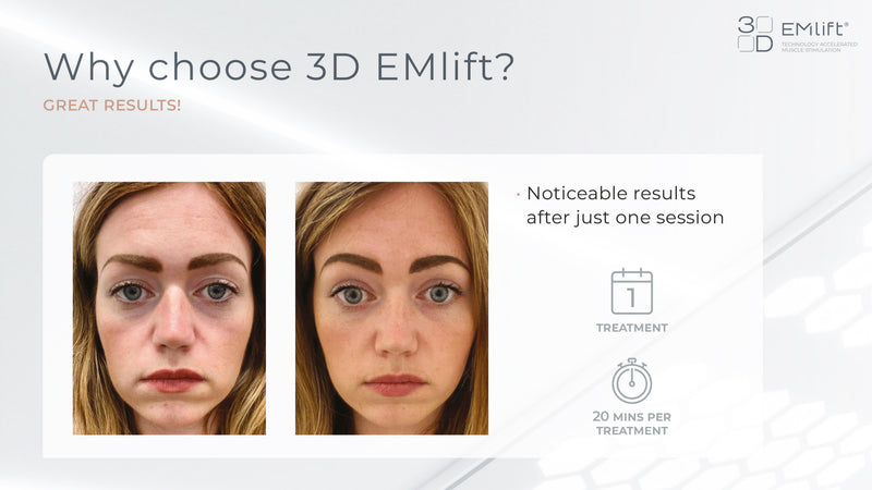 Emlift Facial Lifting