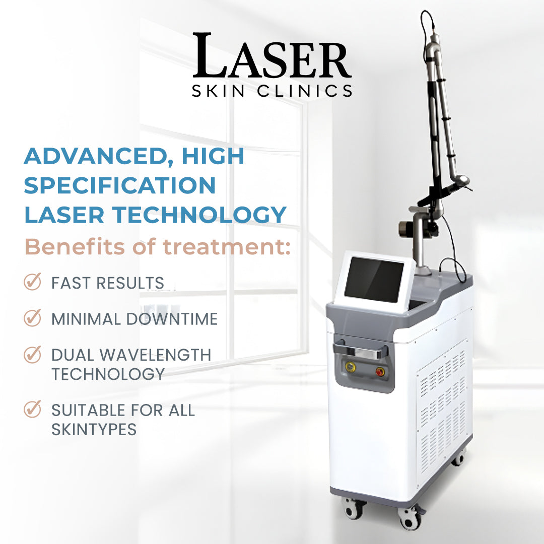 Laser Tattoo Removal