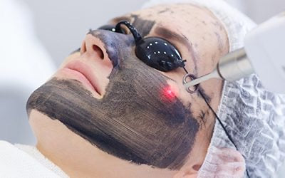 ND Yag Clear or Carbon Paste Laser Facial