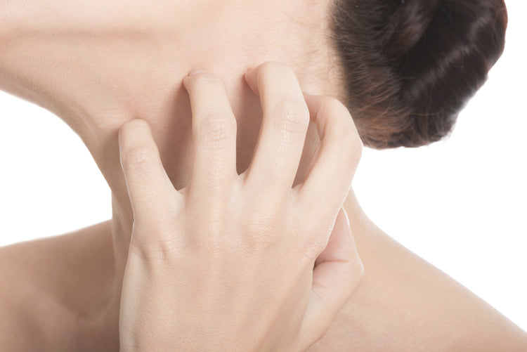 Rosacea Treatment