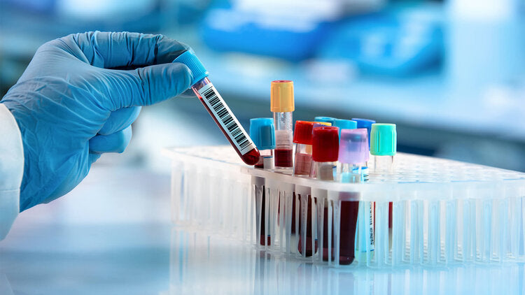 Bespoke Blood Tests