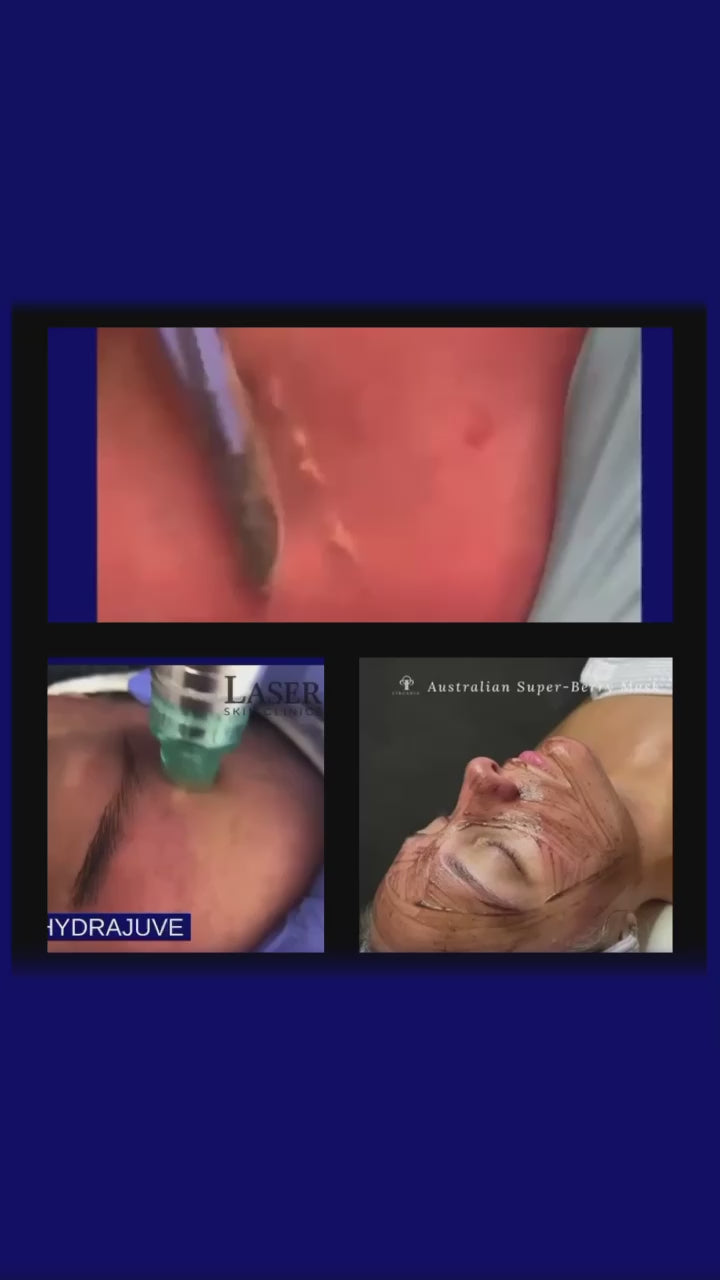 Customised Cocktail Facials