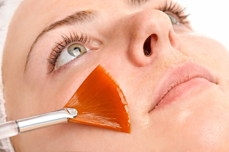 Chemical Peels